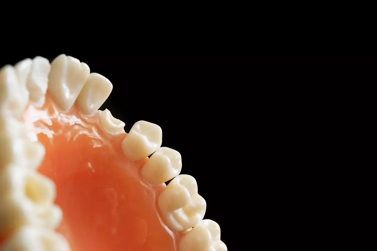 Sonhar com dente caindo – Descubra os significados